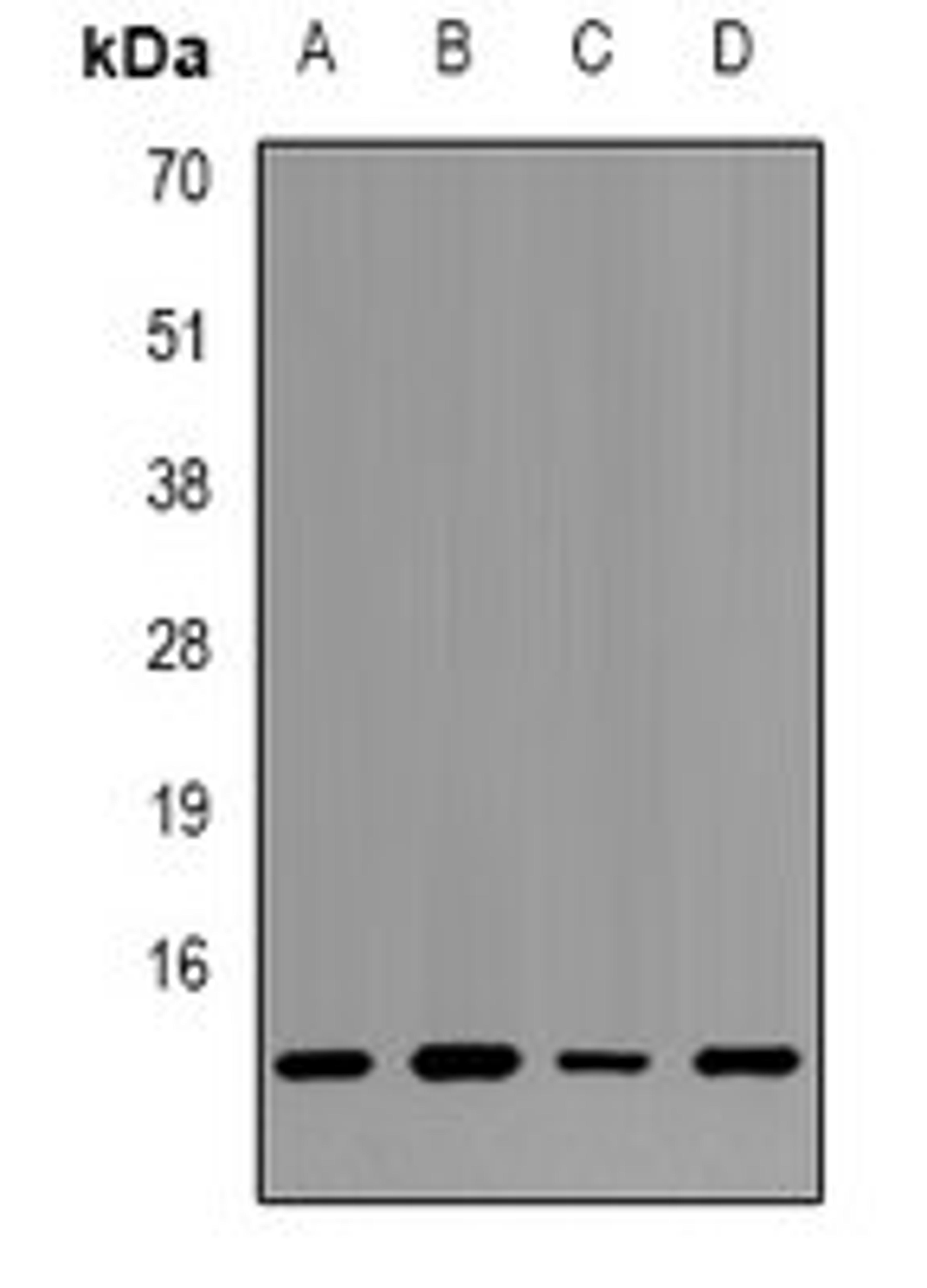 Western blot analysis of Hela (Lane1), HEK293T (Lane2), NIH3T3 (Lane3), mouse kidney (Lane4) whole cell lysates using HIST1H2BC antibody