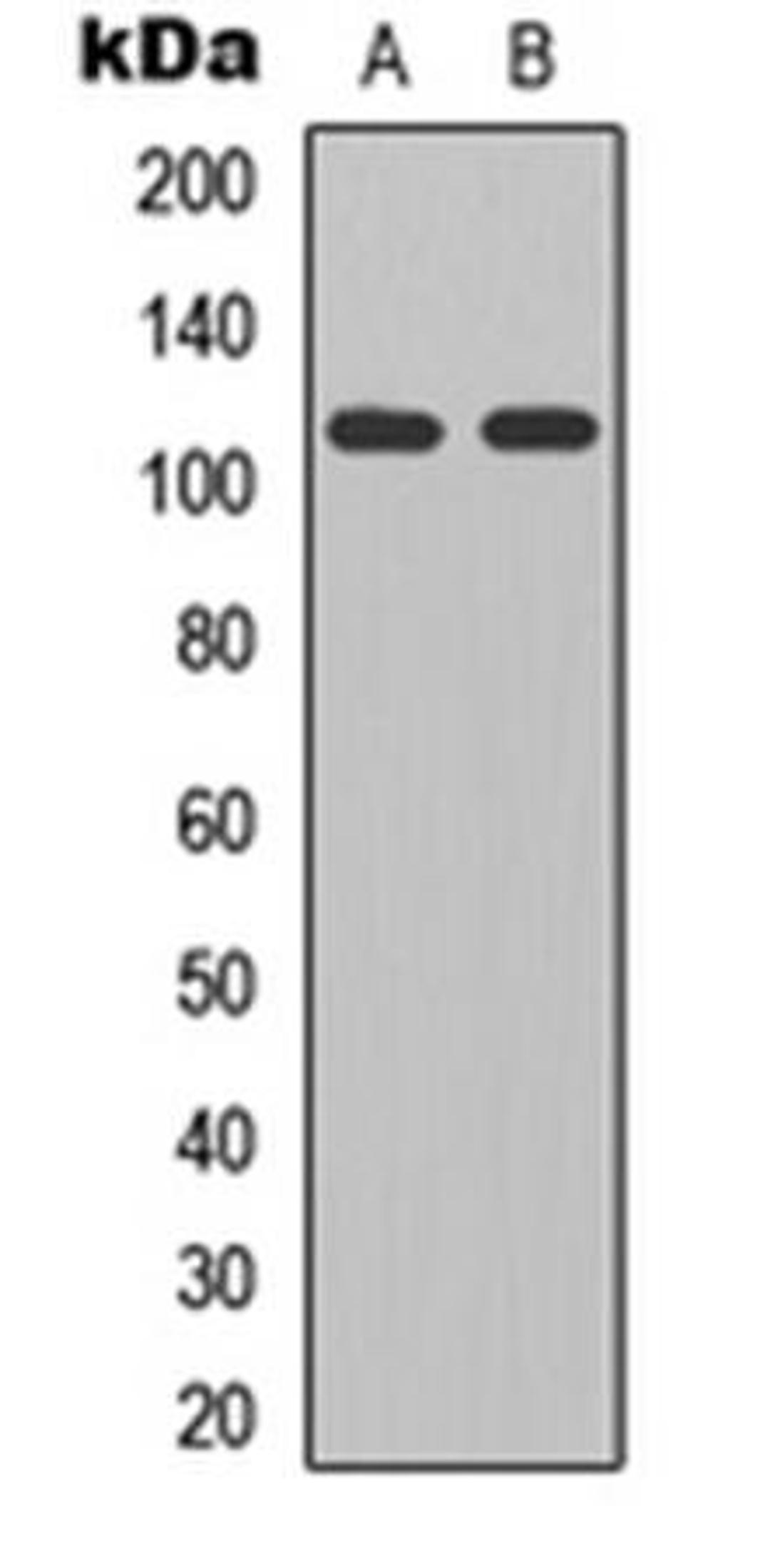 Western blot analysis of HEK293T (Lane1), mouse brain (Lane2) whole cell using GLURD2 antibody