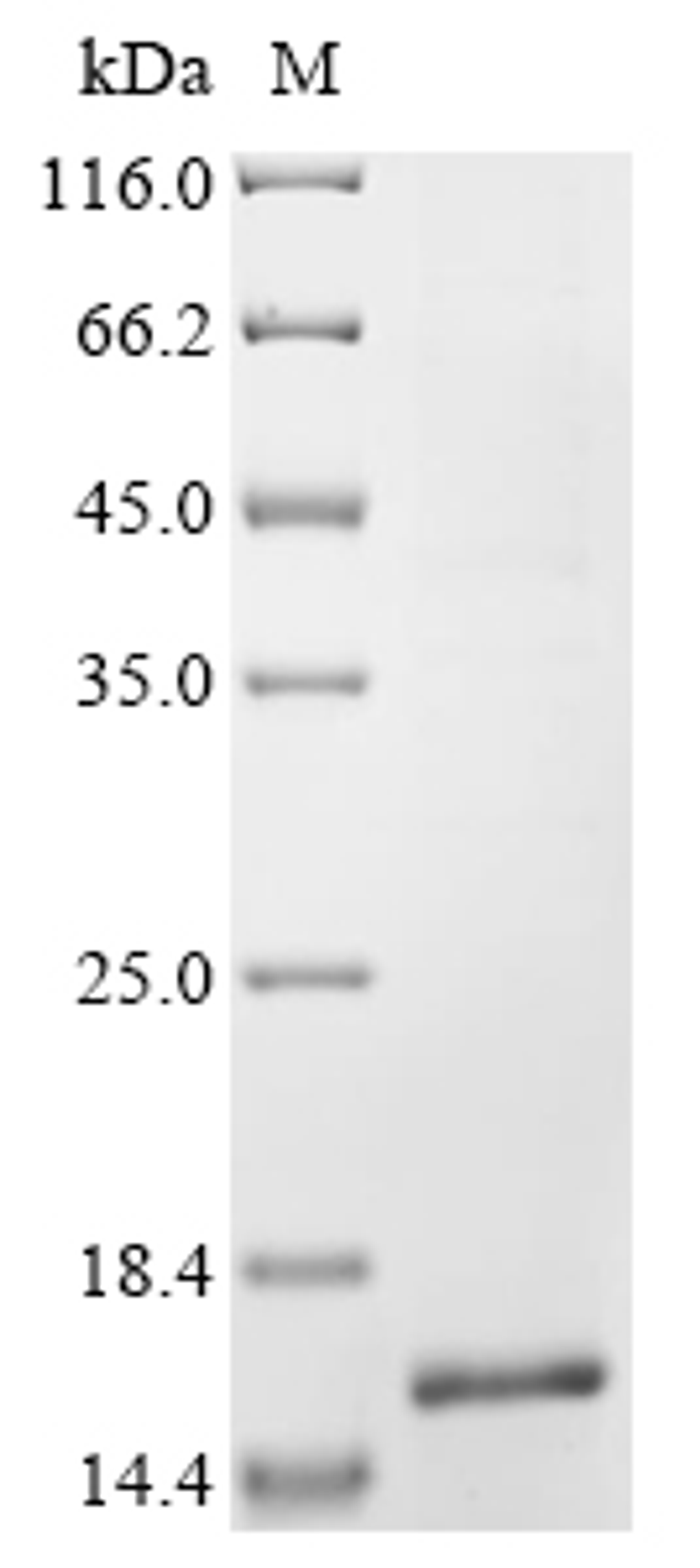 (Tris-Glycine gel) Discontinuous SDS-PAGE (reduced) with 5% enrichment gel and 15% separation gel.