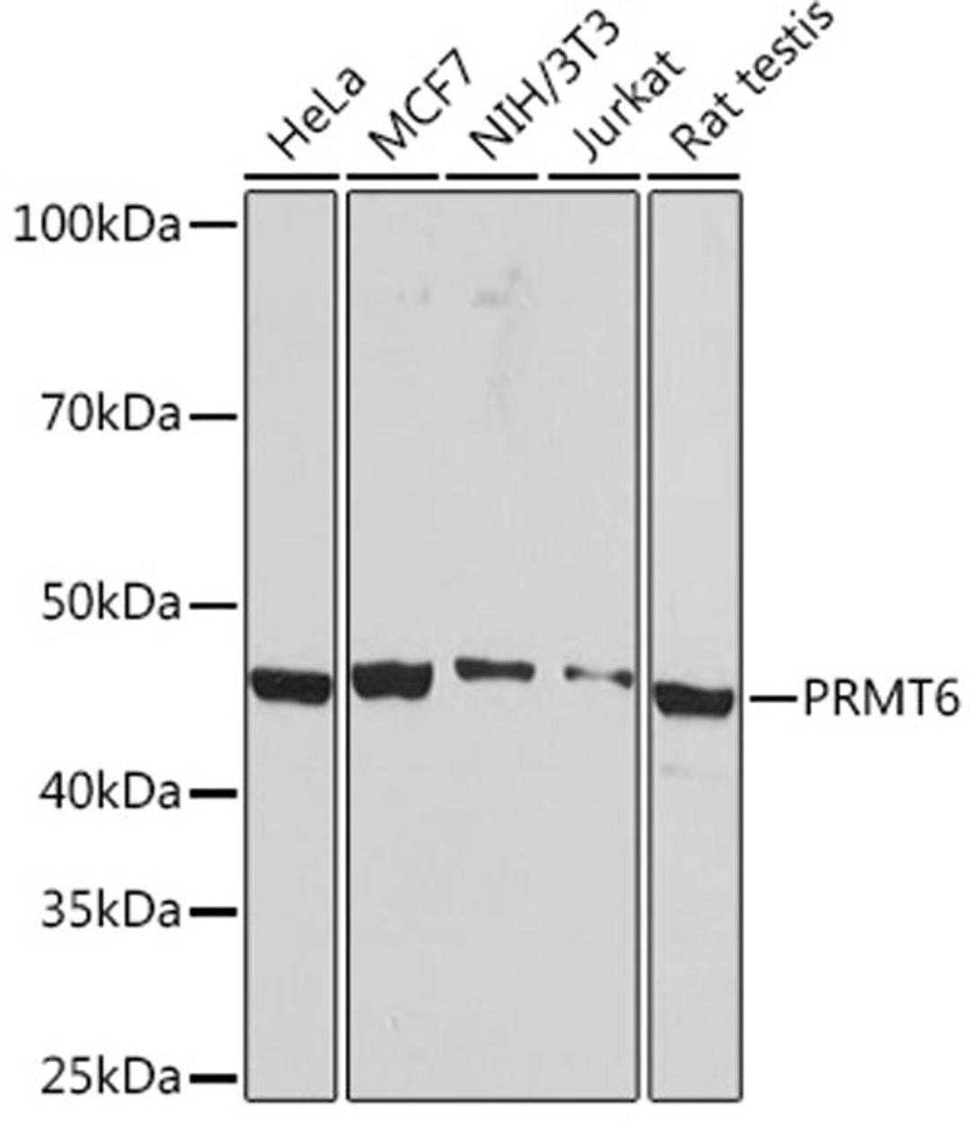 Western blot - PRMT6 Rabbit mAb (A5085)