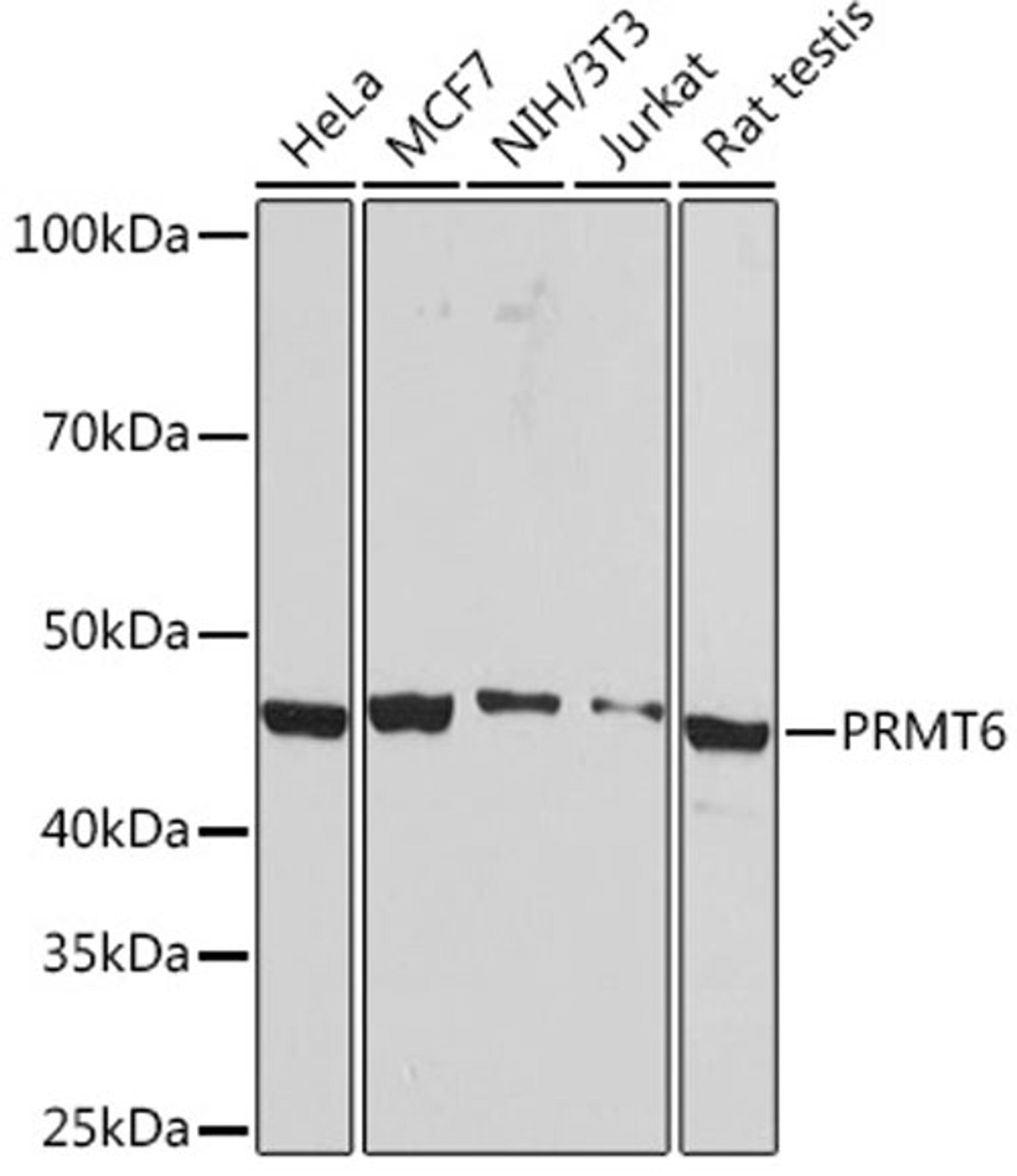 Western blot - PRMT6 Rabbit mAb (A5085)