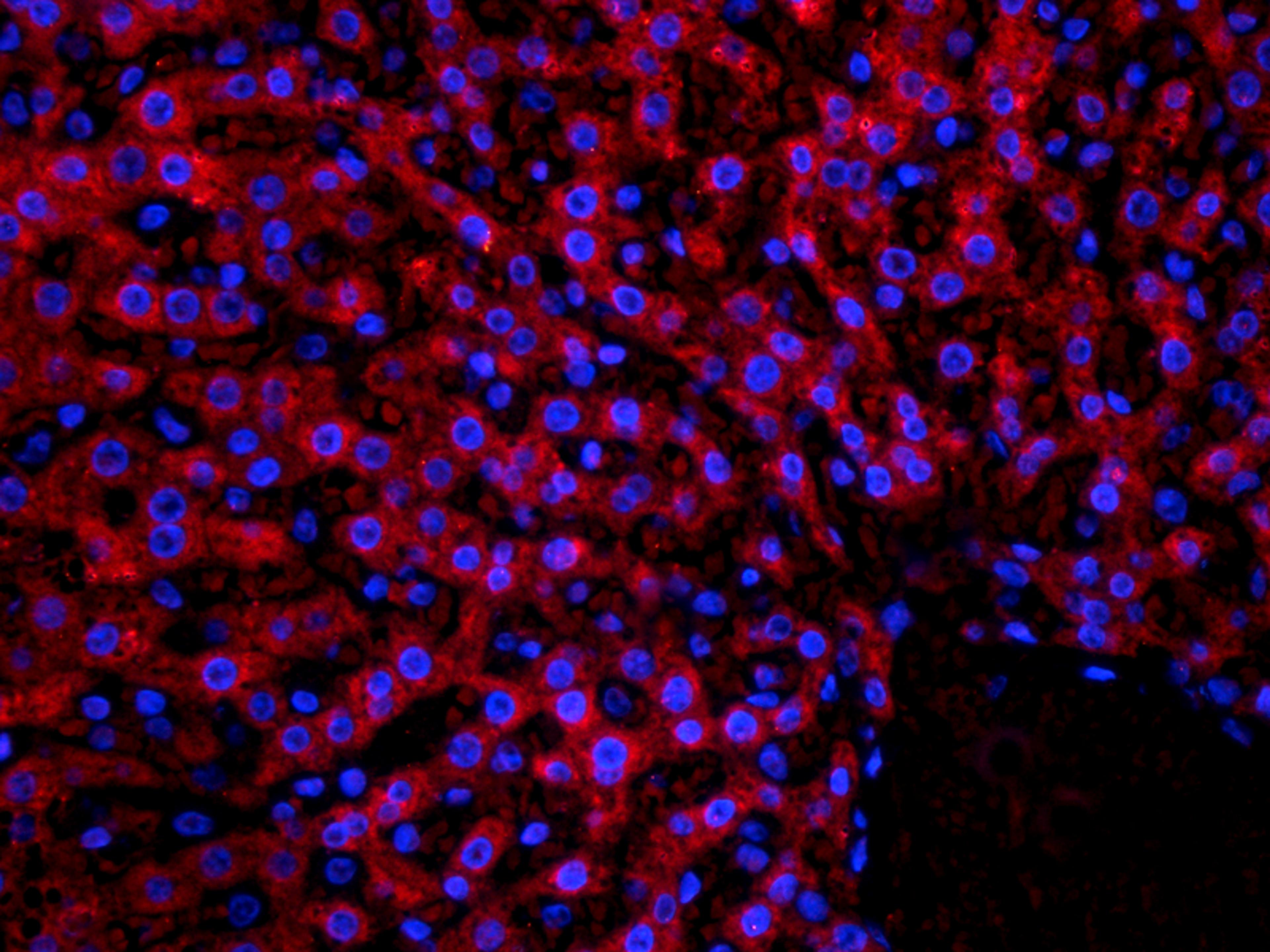 IF image of rat liver tissue using anti-LOXL2 (primary antibody at 1:500)