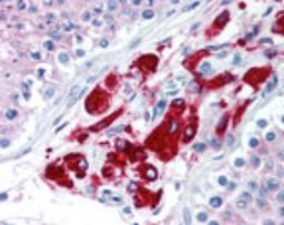 Immunohistochemistry-Paraffin: DUSP16 Antibody [NBP2-24501] - analysis of human testis using this antibody at 10 ug/ml.