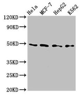 Western Blot. Positive WB detected in: Hela whole cell lysate, MCF-7 whole cell lysate, HepG2 whole cell lysate, K562 whole cell lysate. All lanes: TEAD4 antibody at 2.8µg/ml. Secondary. Goat polyclonal to rabbit IgG at 1/50000 dilution. Predicted band size: 49, 35, 45 kDa. Observed band size: 49 kDa