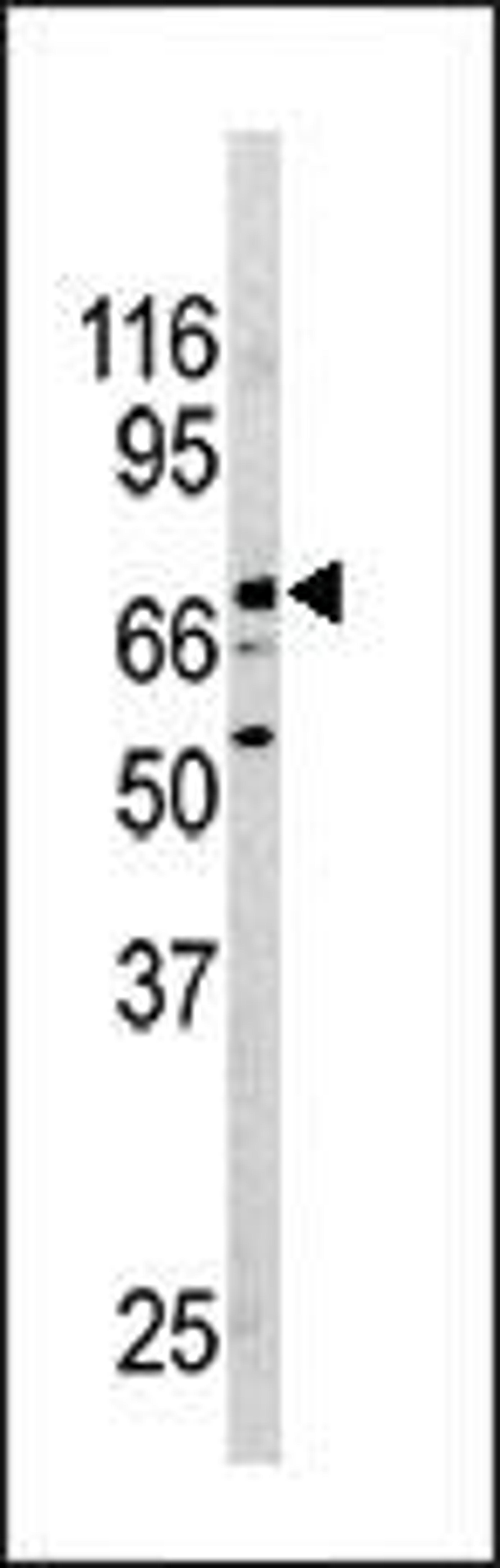 Western blot analysis of anti-NURR1(NR4A2) Pab in mouse brain tissue lysate.