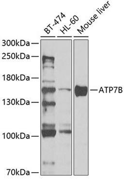 Western blot - ATP7B antibody (A5676)