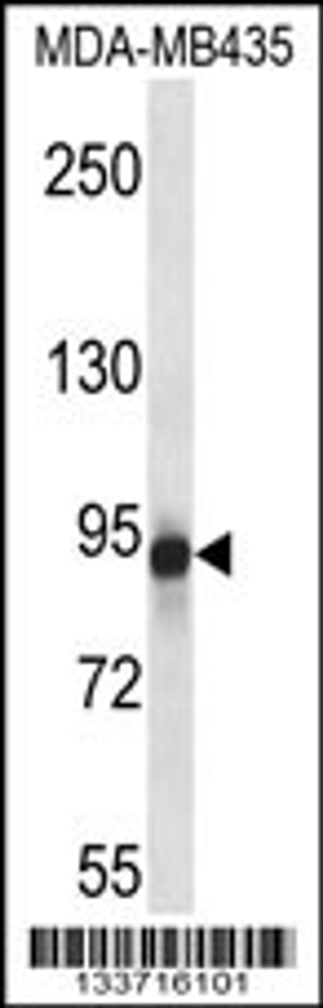 Western blot analysis in MDA-MB435 cell line lysates (35ug/lane).