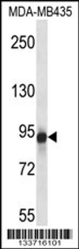 Western blot analysis in MDA-MB435 cell line lysates (35ug/lane).