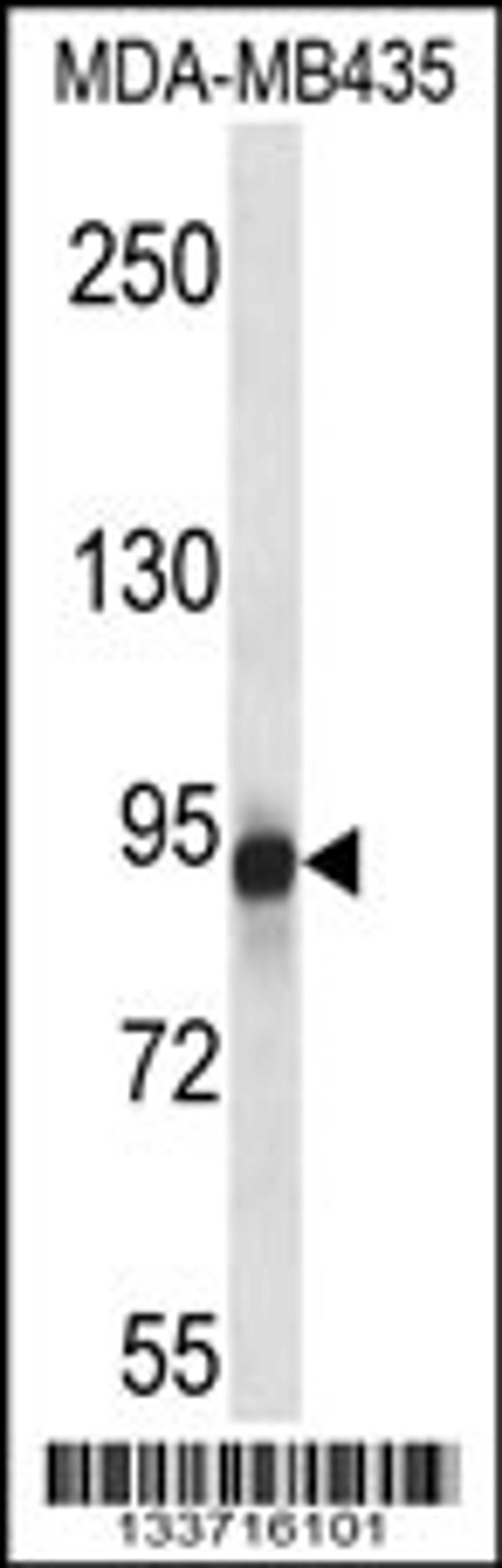 Western blot analysis in MDA-MB435 cell line lysates (35ug/lane).