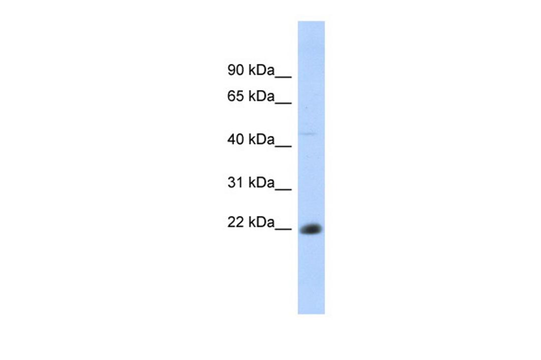 Antibody used in WB on Human Thymus at 0.2-1 ug/ml.