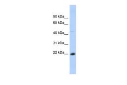 Antibody used in WB on Human Thymus at 0.2-1 ug/ml.