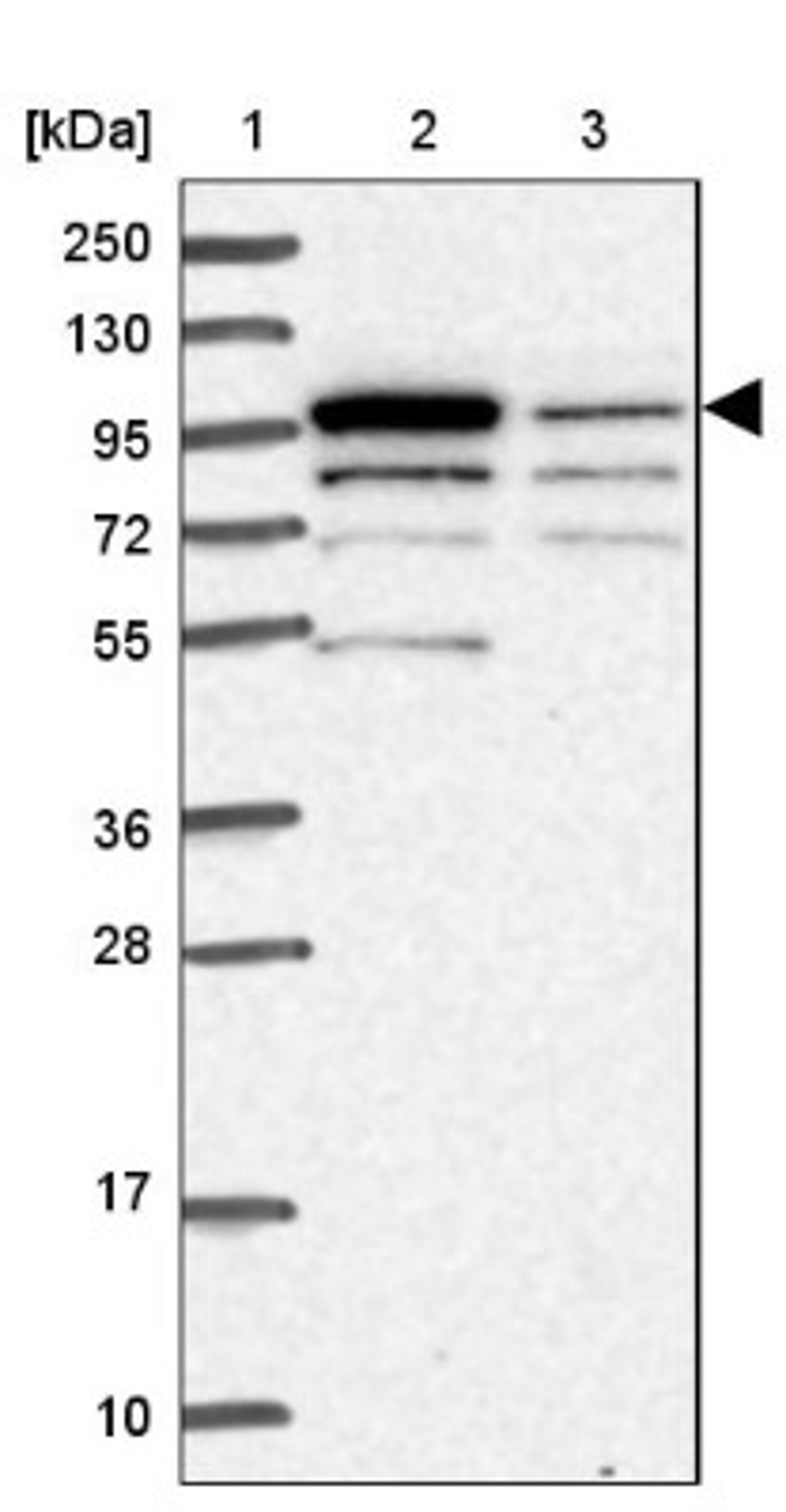 Western Blot: PARP8 Antibody [NBP2-13733] - Lane 1: Marker [kDa] 250, 130, 95, 72, 55, 36, 28, 17, 10<br/>Lane 2: Human cell line RT-4<br/>Lane 3: Human cell line U-251MG sp