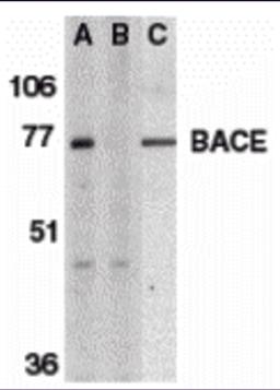 <strong>Figure 1 Western Blot Validation of BACE</strong><br>
Loading: 15 µg of lysates per lane.
Antibodies: BACE (1 &#956;g/mL), 1h incubation at RT in 5% NFDM/TBST.
Secondary: Goat anti-rabbit IgG HRP conjugate at 1:10000 dilution.
Lane A-C: human brai