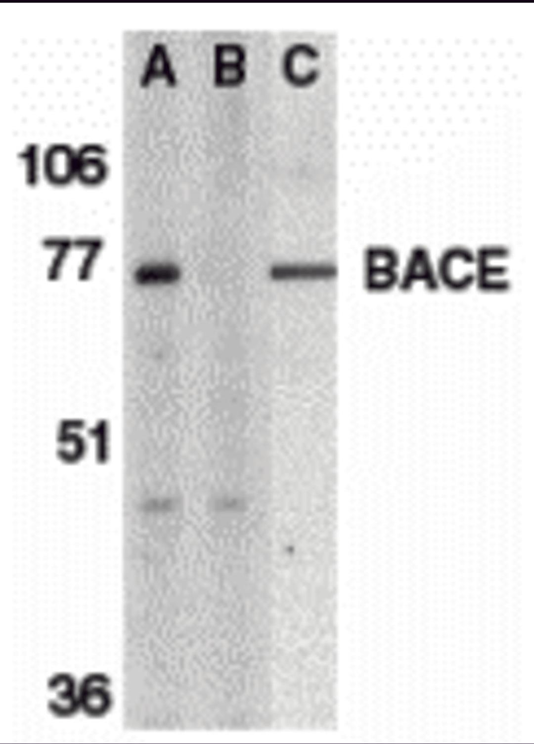 <strong>Figure 1 Western Blot Validation of BACE</strong><br>
Loading: 15 µg of lysates per lane.
Antibodies: BACE (1 μg/mL), 1h incubation at RT in 5% NFDM/TBST.
Secondary: Goat anti-rabbit IgG HRP conjugate at 1:10000 dilution.
Lane A-C: human brai