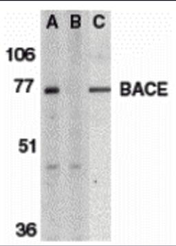 <strong>Figure 1 Western Blot Validation of BACE</strong><br>
Loading: 15 µg of lysates per lane.
Antibodies: BACE (1 μg/mL), 1h incubation at RT in 5% NFDM/TBST.
Secondary: Goat anti-rabbit IgG HRP conjugate at 1:10000 dilution.
Lane A-C: human brai