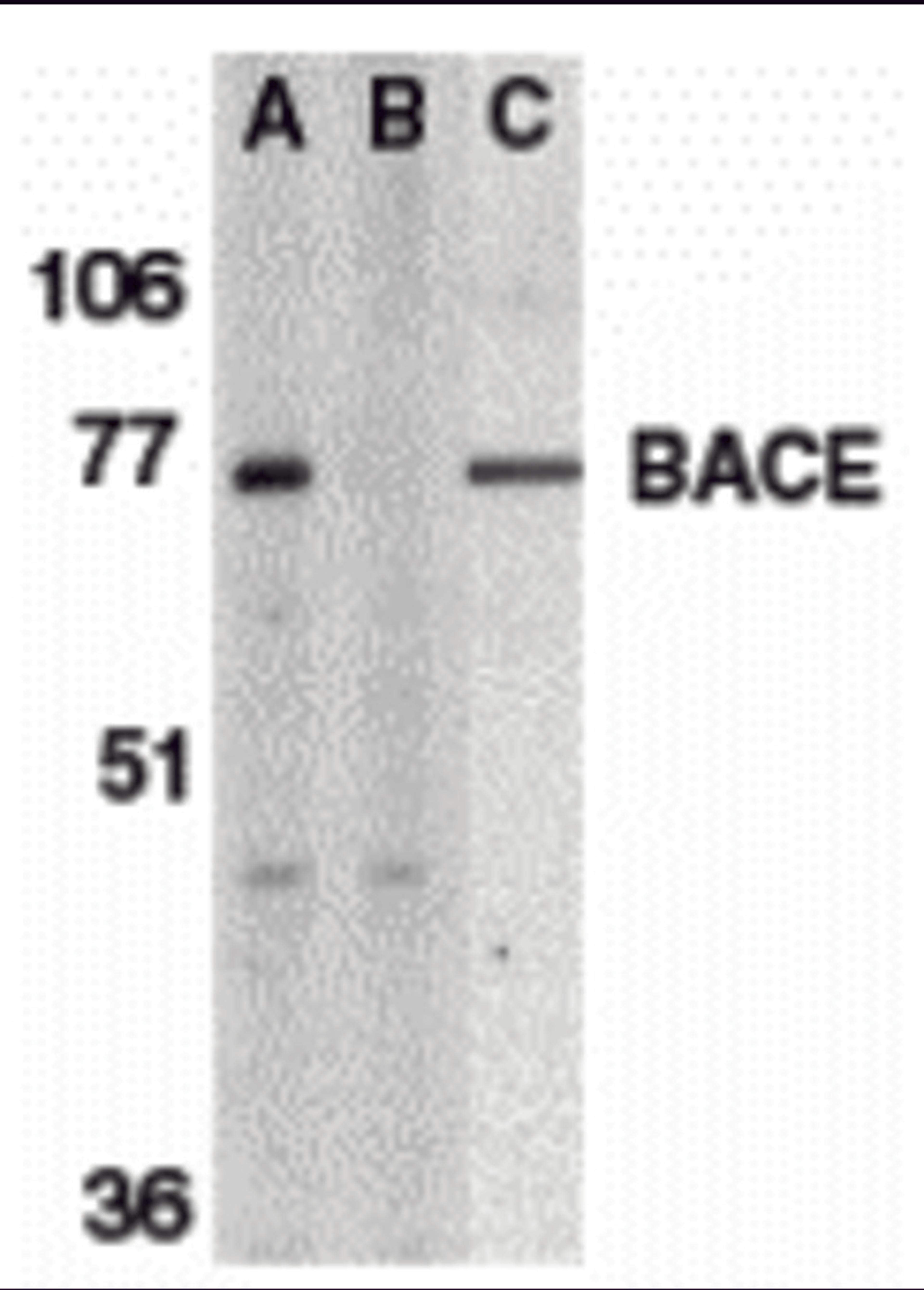 <strong>Figure 1 Western Blot Validation of BACE</strong><br>
Loading: 15 µg of lysates per lane.
Antibodies: BACE (1 μg/mL), 1h incubation at RT in 5% NFDM/TBST.
Secondary: Goat anti-rabbit IgG HRP conjugate at 1:10000 dilution.
Lane A-C: human brai