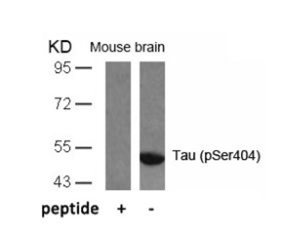 Western blot analysis of lysed extracts from mouse brain tissue using Tau (Phospho-Ser404).