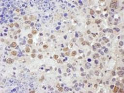 Detection of mouse TRIM33/TIF1gamma by immunohistochemistry.