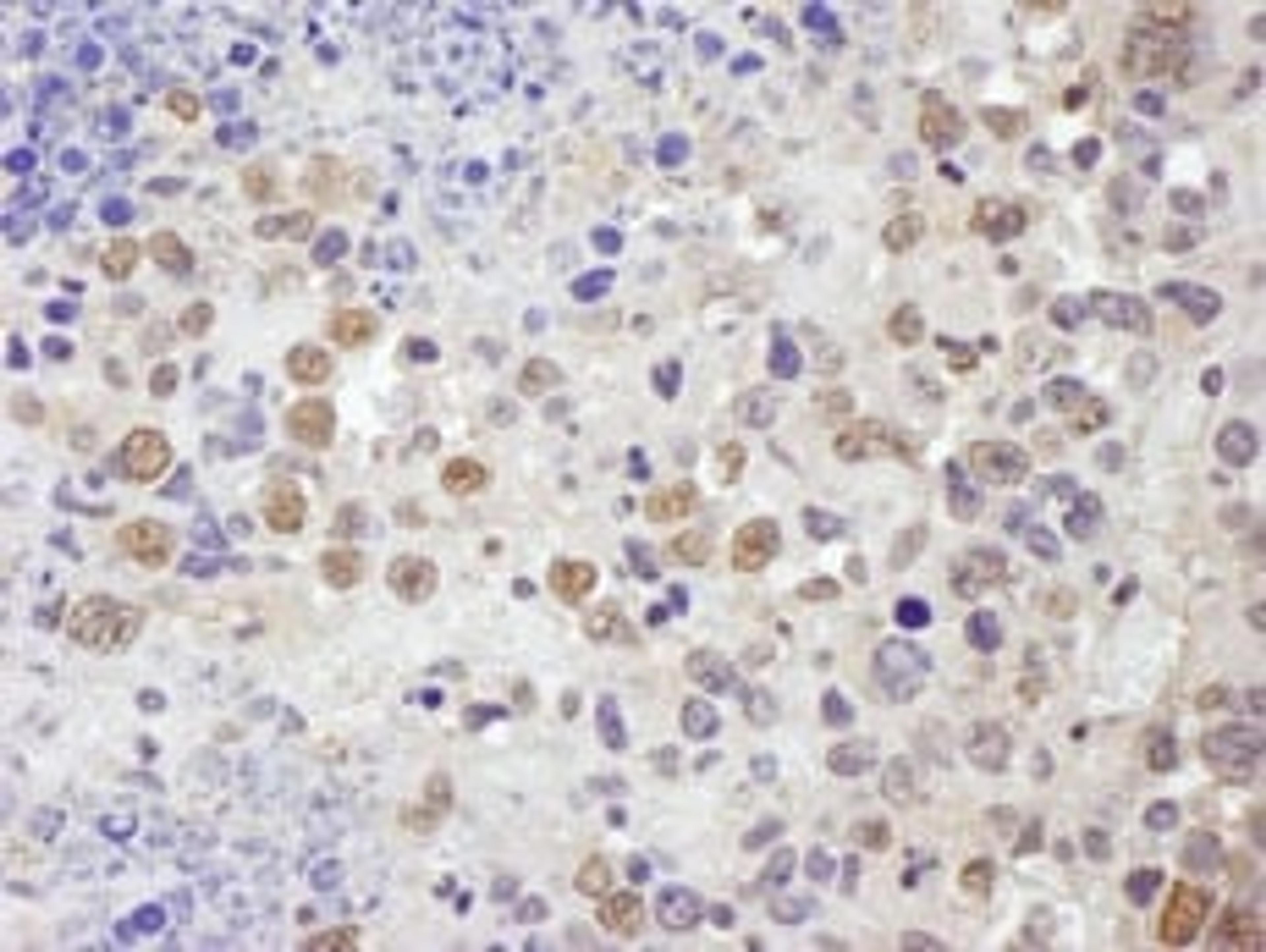 Detection of mouse TRIM33/TIF1gamma by immunohistochemistry.