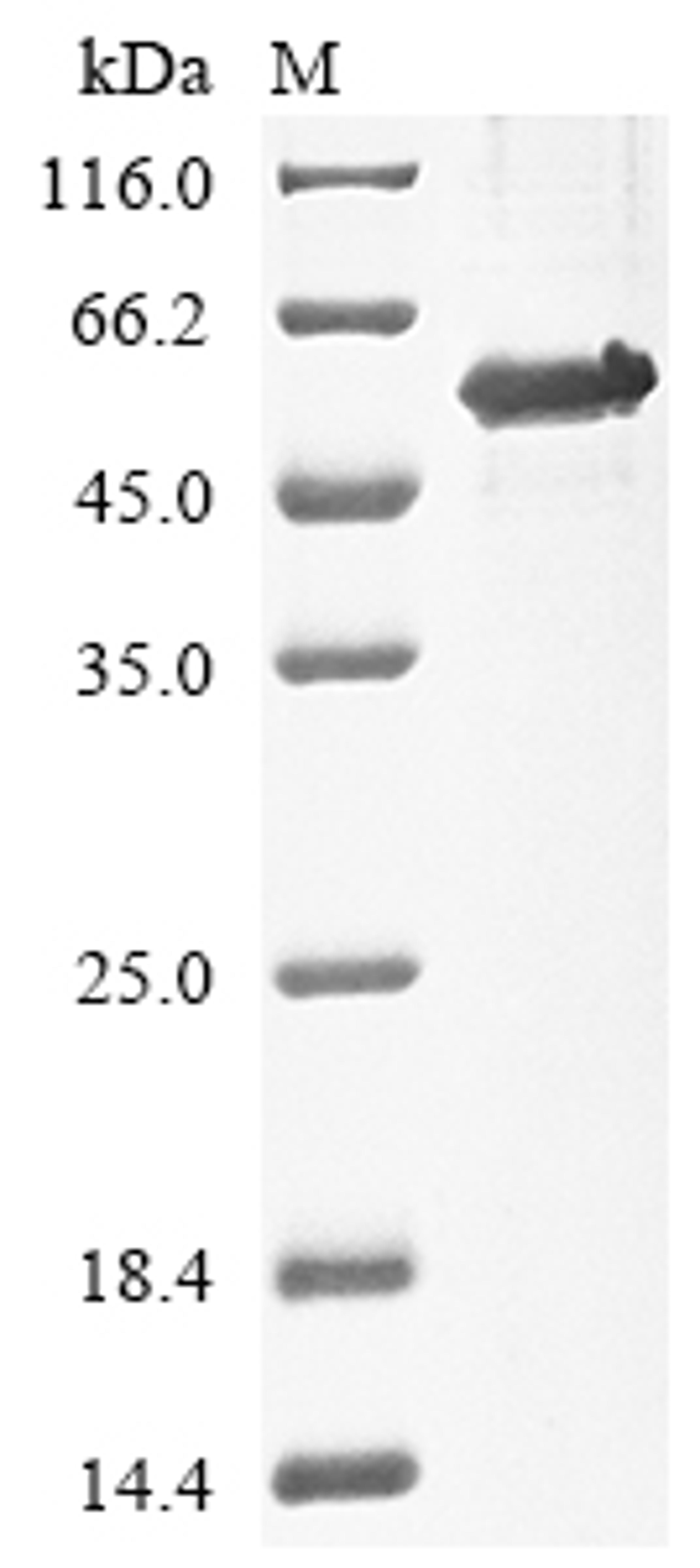 (Tris-Glycine gel) Discontinuous SDS-PAGE (reduced) with 5% enrichment gel and 15% separation gel.