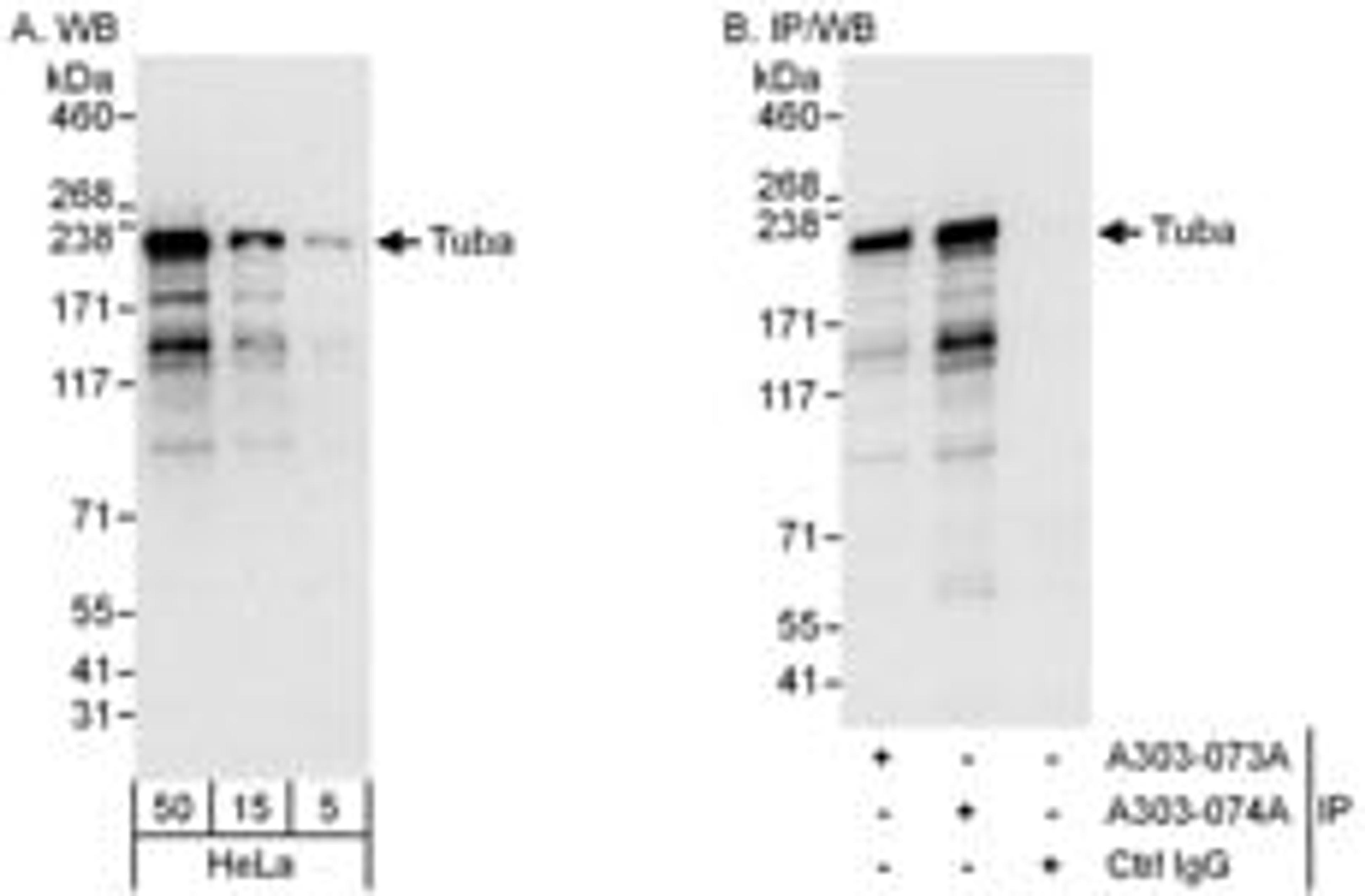 Detection of human Tuba by western blot and immunoprecipitation.