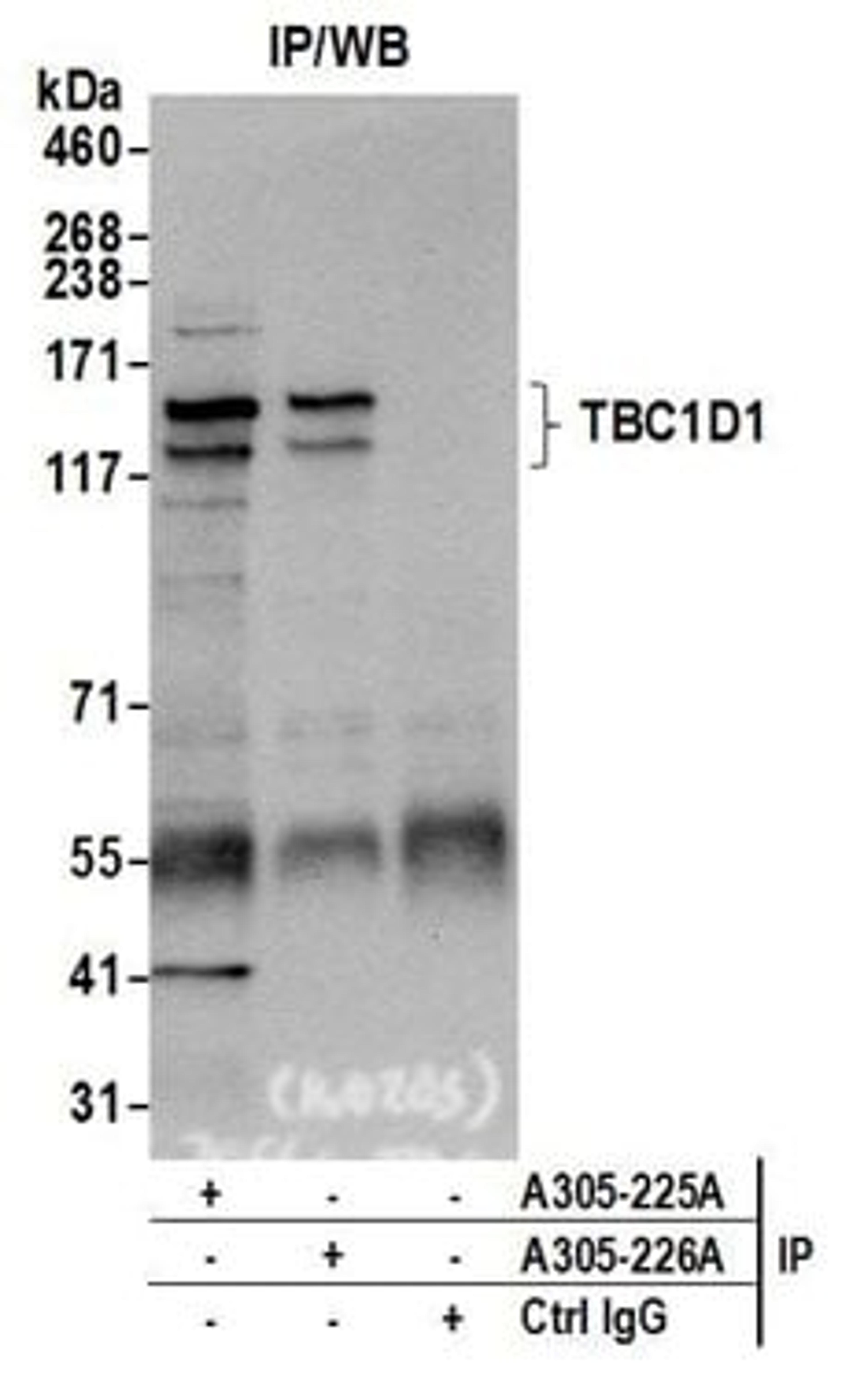 Detection of human TBC1D1 by western blot of immunoprecipitates.