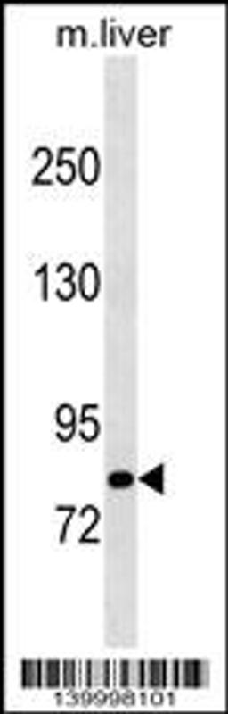 Western blot analysis in mouse liver tissue lysates (35ug/lane).