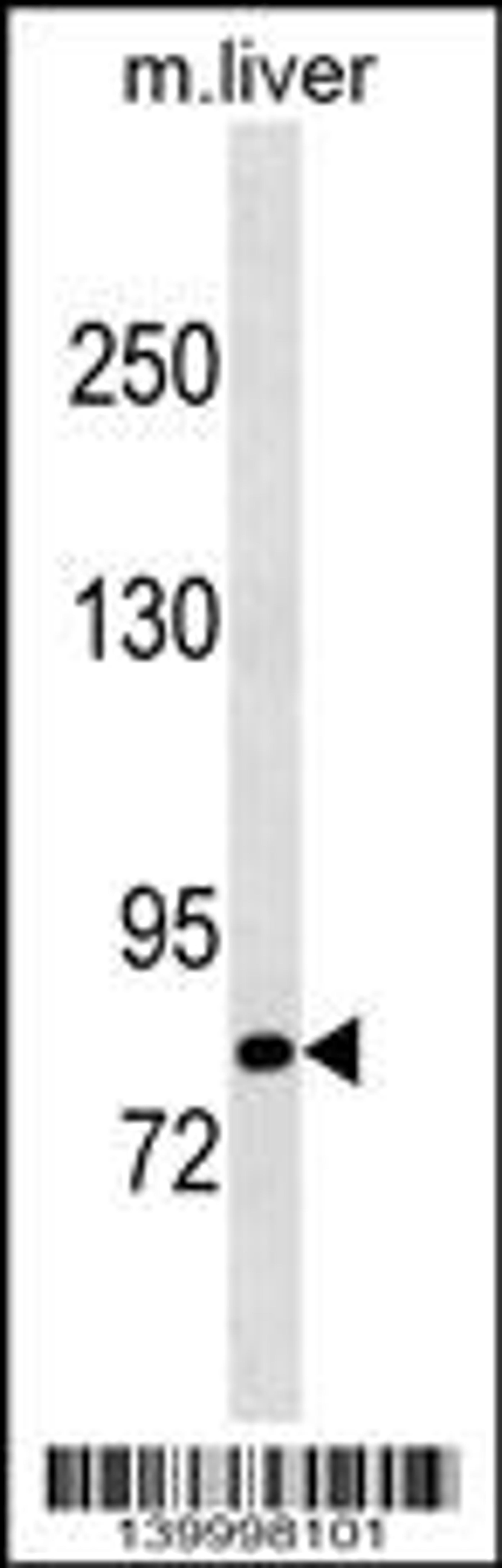 Western blot analysis in mouse liver tissue lysates (35ug/lane).