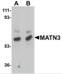 Western blot analysis of MATN3 in rat thymus tissue lysate with MATN3 antibody at (A) 1 and (B) 2 &#956;g/mL.