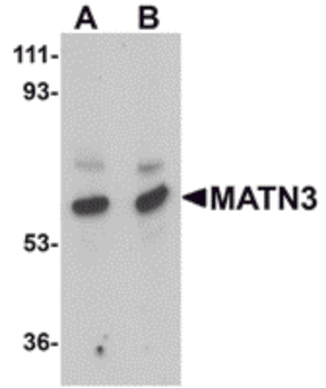 Western blot analysis of MATN3 in rat thymus tissue lysate with MATN3 antibody at (A) 1 and (B) 2 μg/mL.