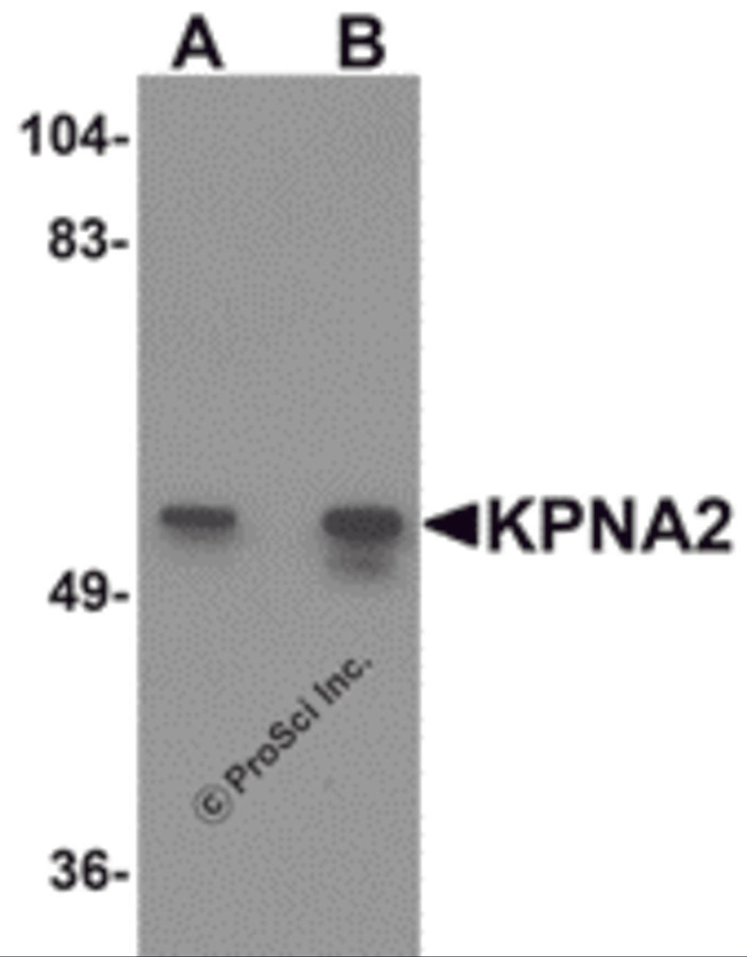 Western blot analysis of KPNA2 in rat heart tissue lysate with KPNA2 antibody at (A) 1 and (B) 2 &#956;g/mL.