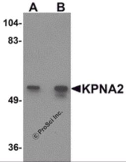 Western blot analysis of KPNA2 in rat heart tissue lysate with KPNA2 antibody at (A) 1 and (B) 2 &#956;g/mL.