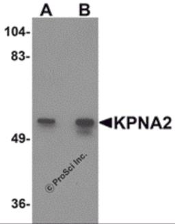 Western blot analysis of KPNA2 in rat heart tissue lysate with KPNA2 antibody at (A) 1 and (B) 2 μg/mL.