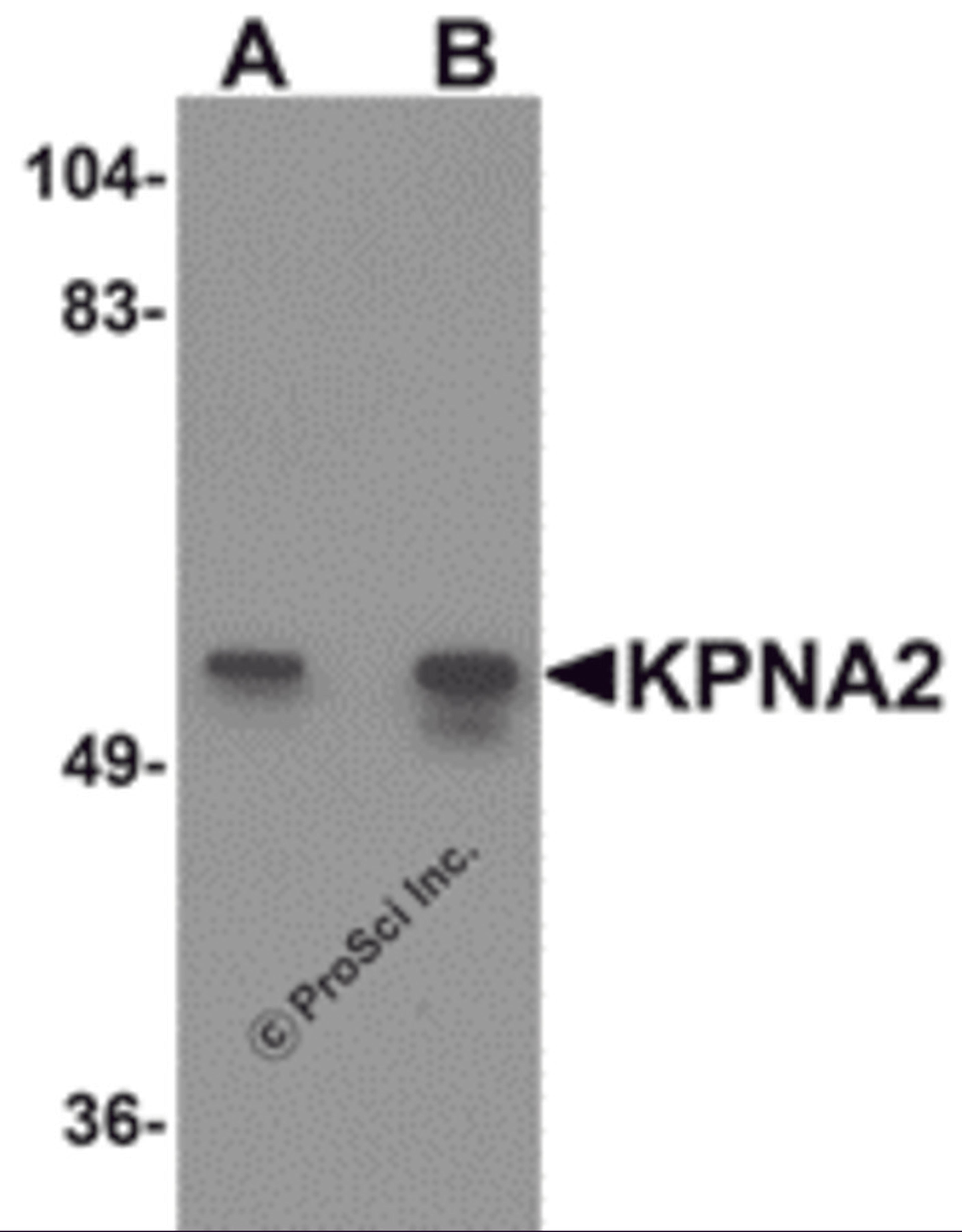 Western blot analysis of KPNA2 in rat heart tissue lysate with KPNA2 antibody at (A) 1 and (B) 2 μg/mL.