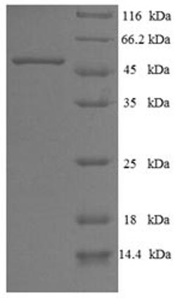 (Tris-Glycine gel) Discontinuous SDS-PAGE (reduced) with 5% enrichment gel and 15% separation gel.