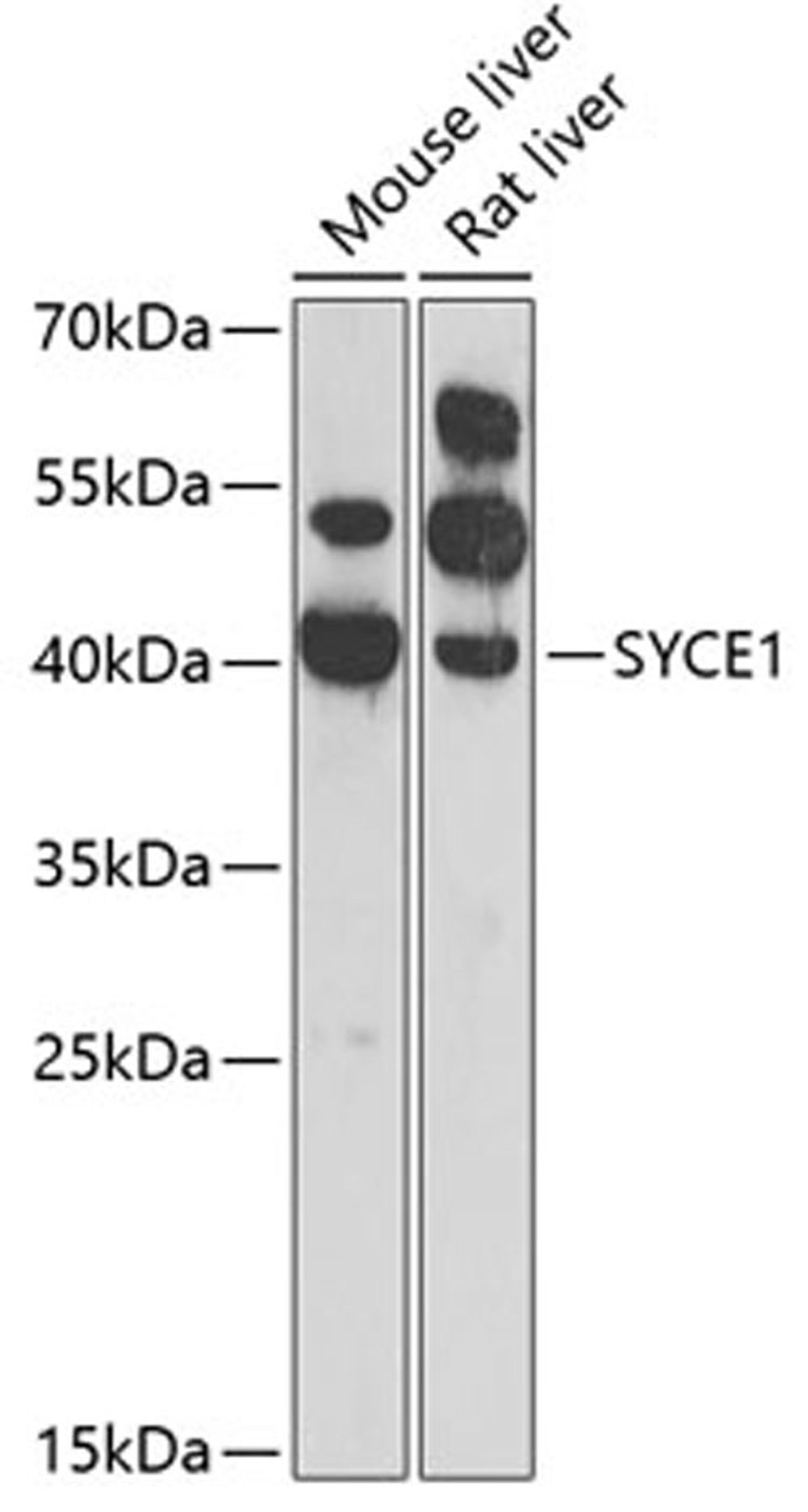 Western blot - SYCE1 antibody (A7218)