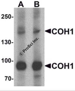 Western blot analysis of COH1 in SK-N-SH cell lysate with COH1 antibody at (A) 1 and (B) 2 μg/mL.