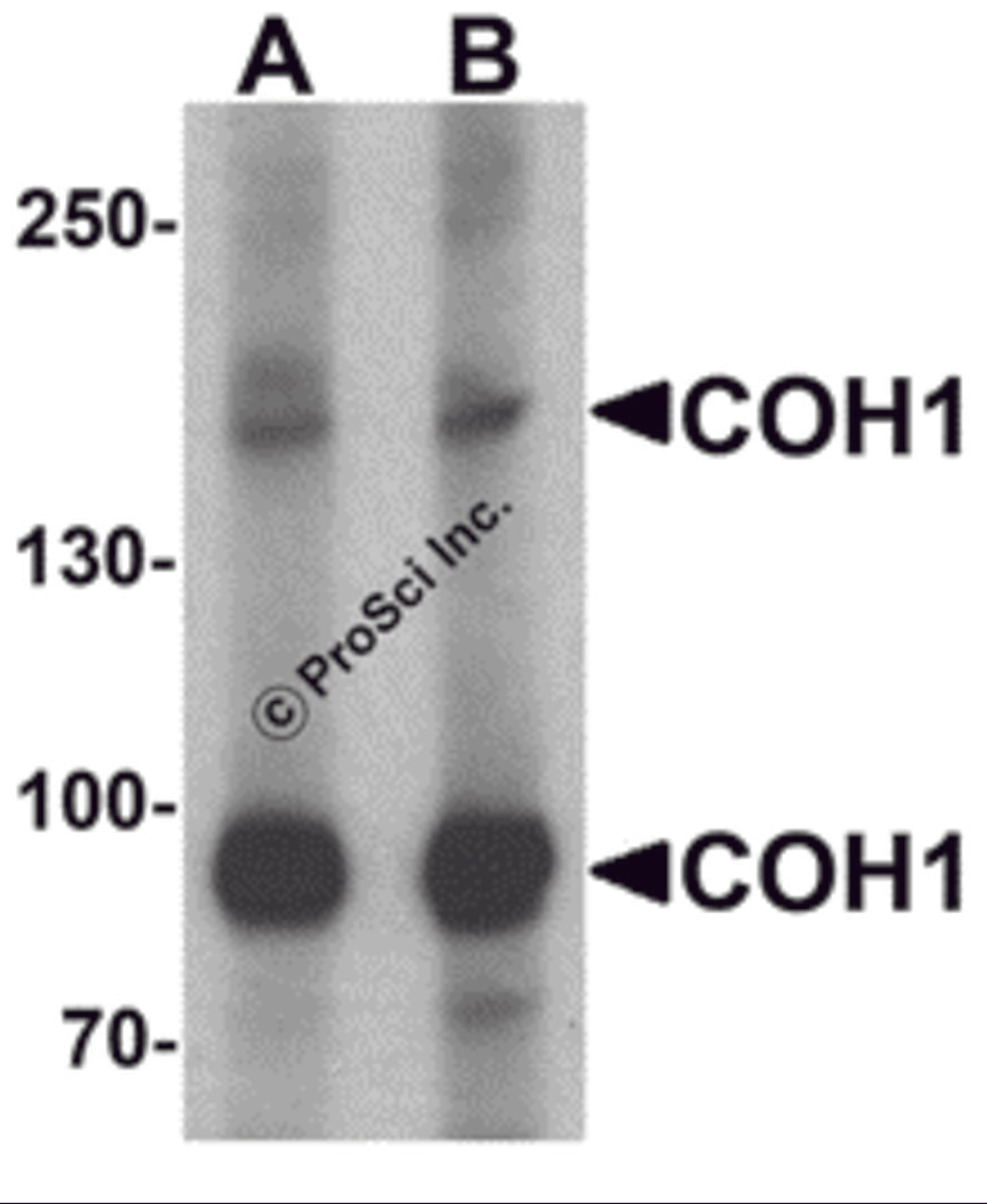 Western blot analysis of COH1 in SK-N-SH cell lysate with COH1 antibody at (A) 1 and (B) 2 μg/mL.