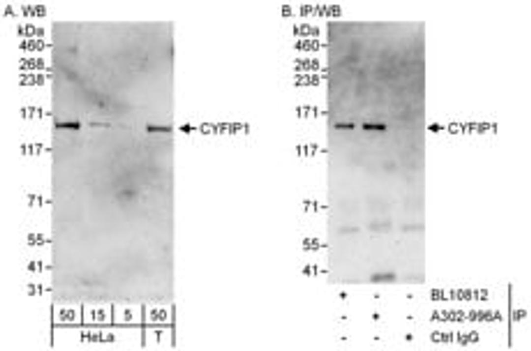 Detection of human CYFIP1 by western blot and immunoprecipitation.