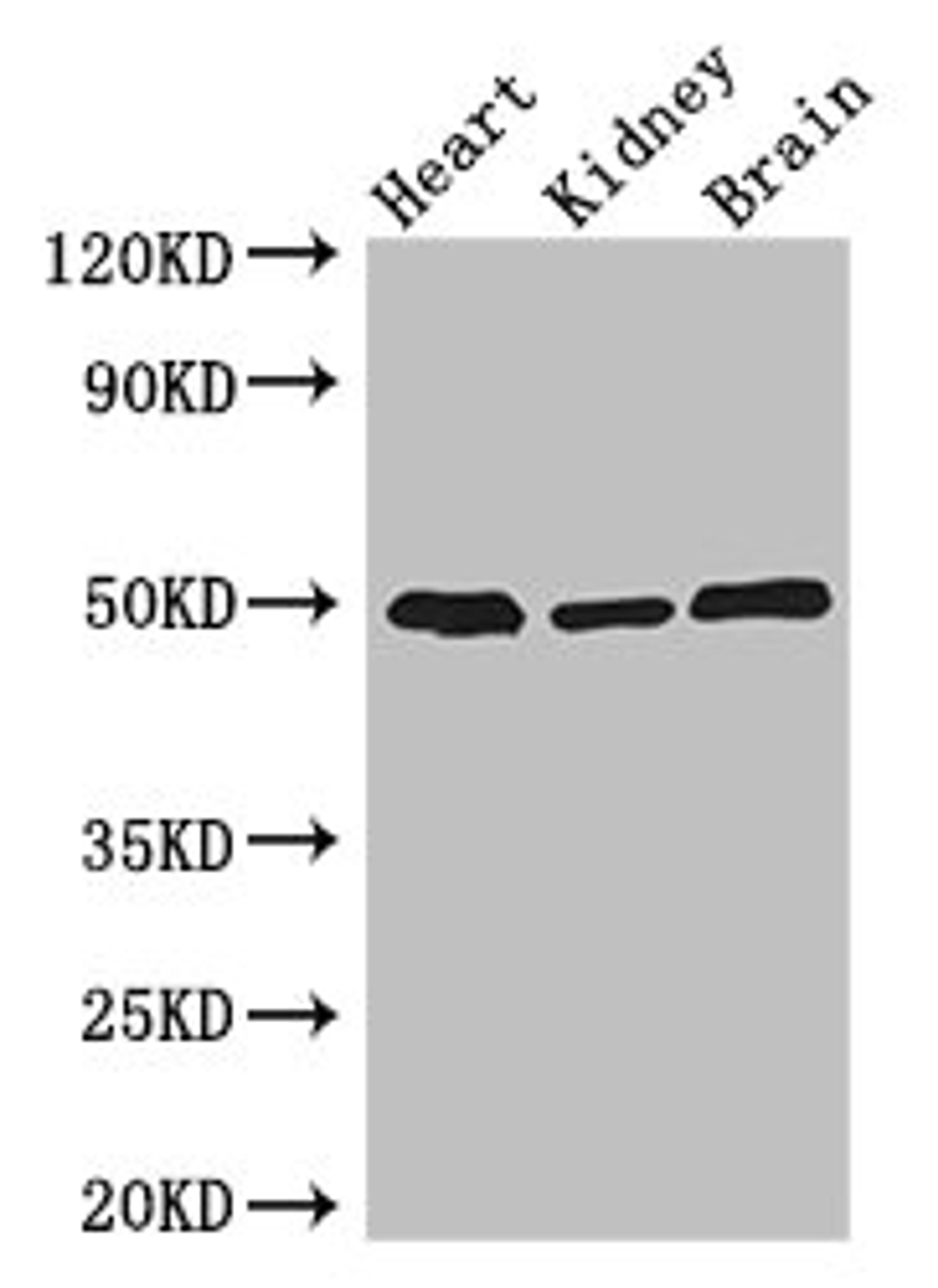 Western Blot. Positive WB detected in: Mouse heart tissue, Mouse kidney tissue, Mouse brain tissue. All lanes: ANKRD10 antibody at 4ug/ml. Secondary. Goat polyclonal to rabbit IgG at 1/50000 dilution. Predicted band size: 45, 24 kDa. Observed band size: 50 kDa.