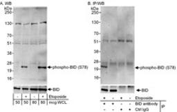 Detection of mouse Phospho-BID (S78) after Treatment with Etoposide.