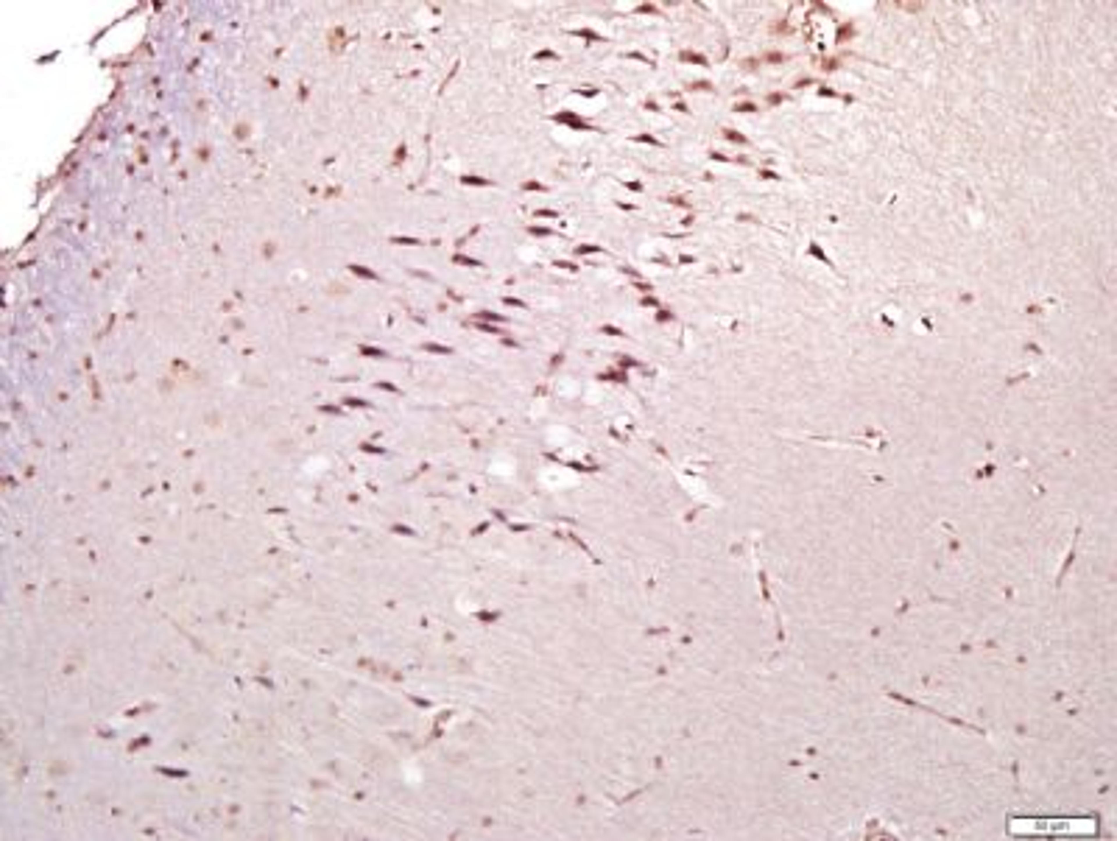 Immunohistochemical staining of rat brain tissue using SLC38A2 antibody.