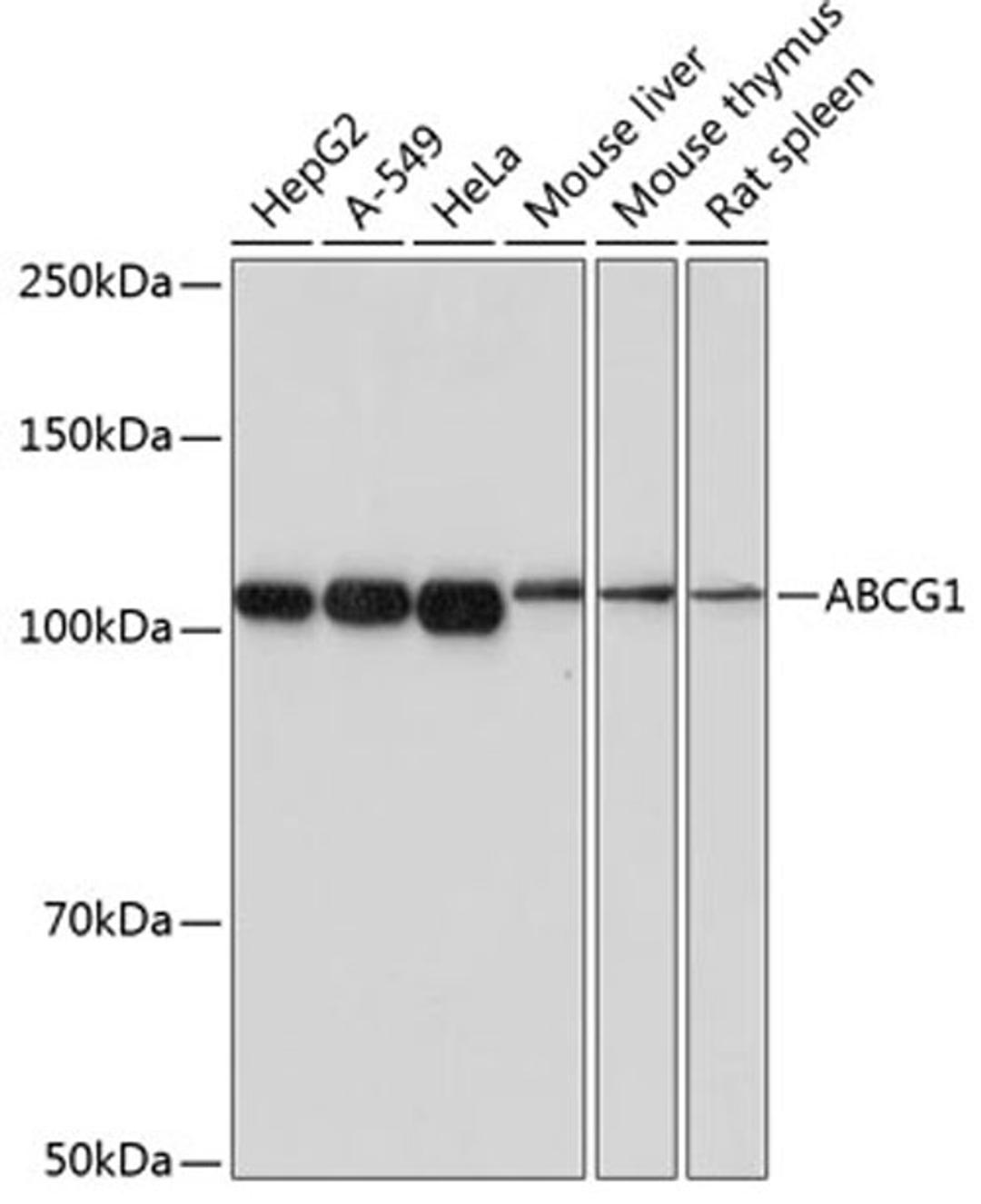 Western blot - ABCG1 antibody (A17907)