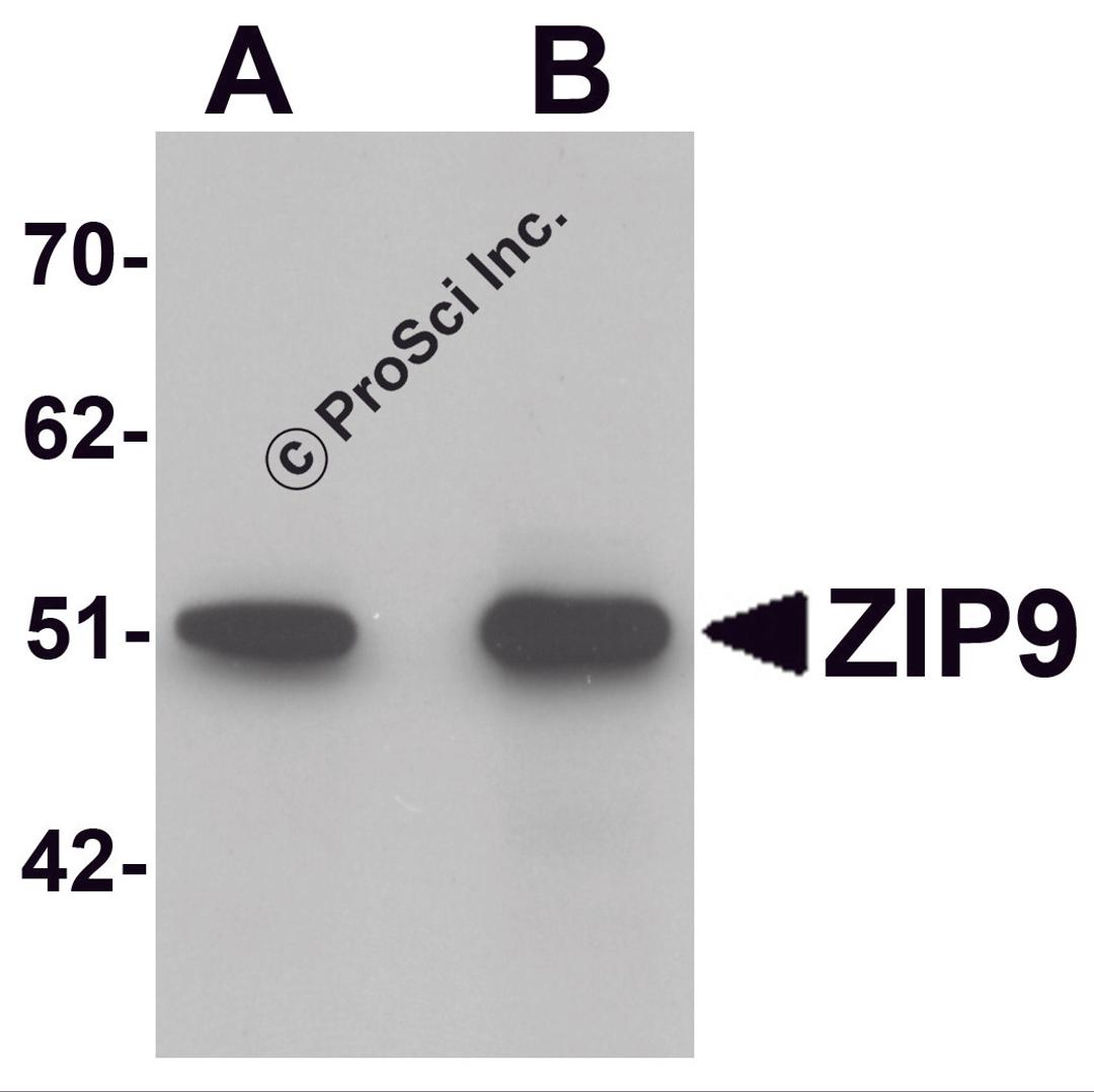 Western blot analysis of ZIP9 in HepG2 cell lysate with ZIP9 antibody at (A) 1 and (B) 2 &#956;g/mL.