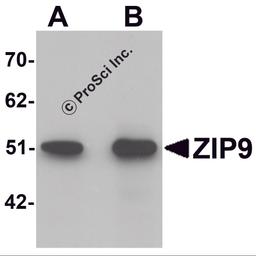 Western blot analysis of ZIP9 in HepG2 cell lysate with ZIP9 antibody at (A) 1 and (B) 2 μg/mL.