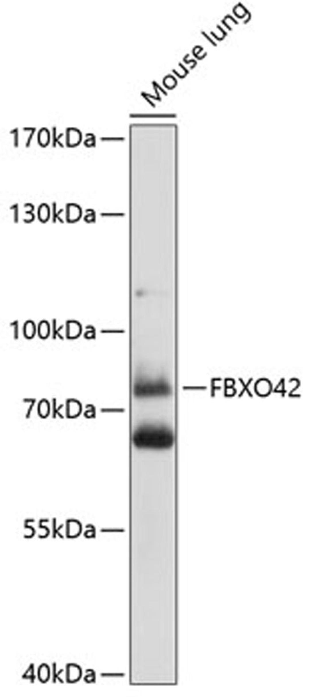 Western blot - FBXO42 antibody (A14898)