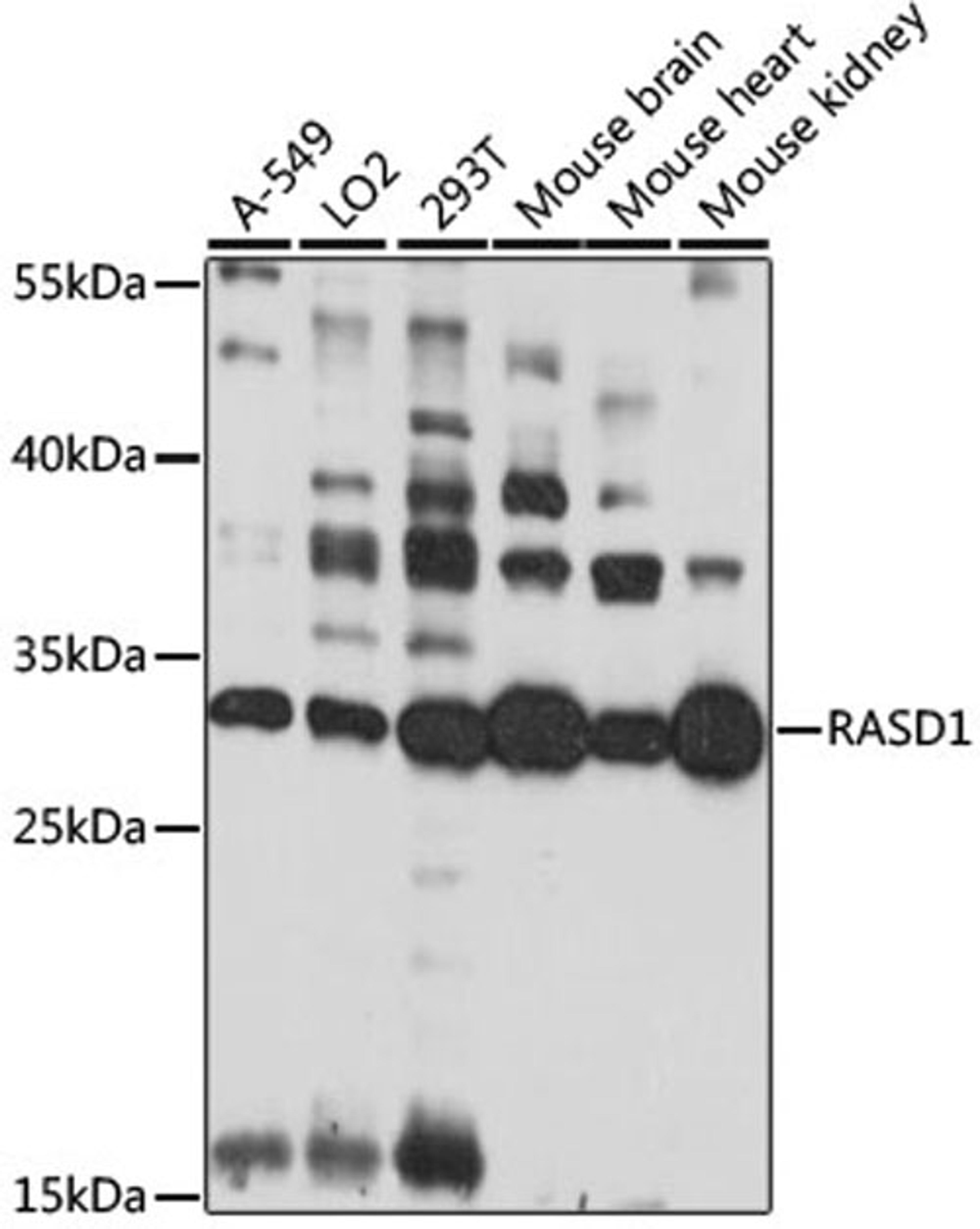 Western blot - RASD1 antibody (A15451)