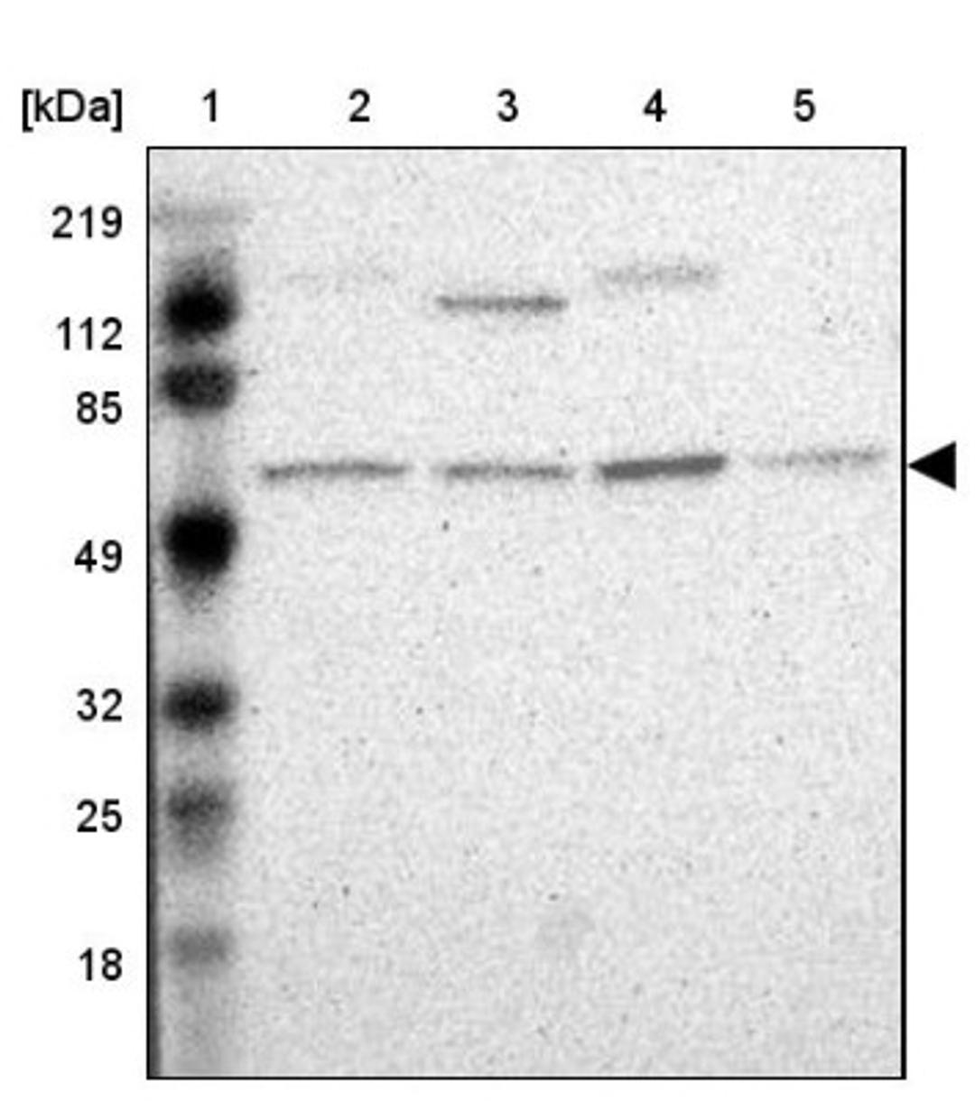 Western Blot: APOBEC3G Antibody [NBP1-88592] - Lane 1: Marker [kDa] 219, 112, 85, 49, 32, 25, 18<br/>Lane 2: Human cell line RT-4<br/>Lane 3: Human cell line U-251MG sp<br/>Lane 4: Human cell line A-431<br/>Lane 5: Human liver tissue