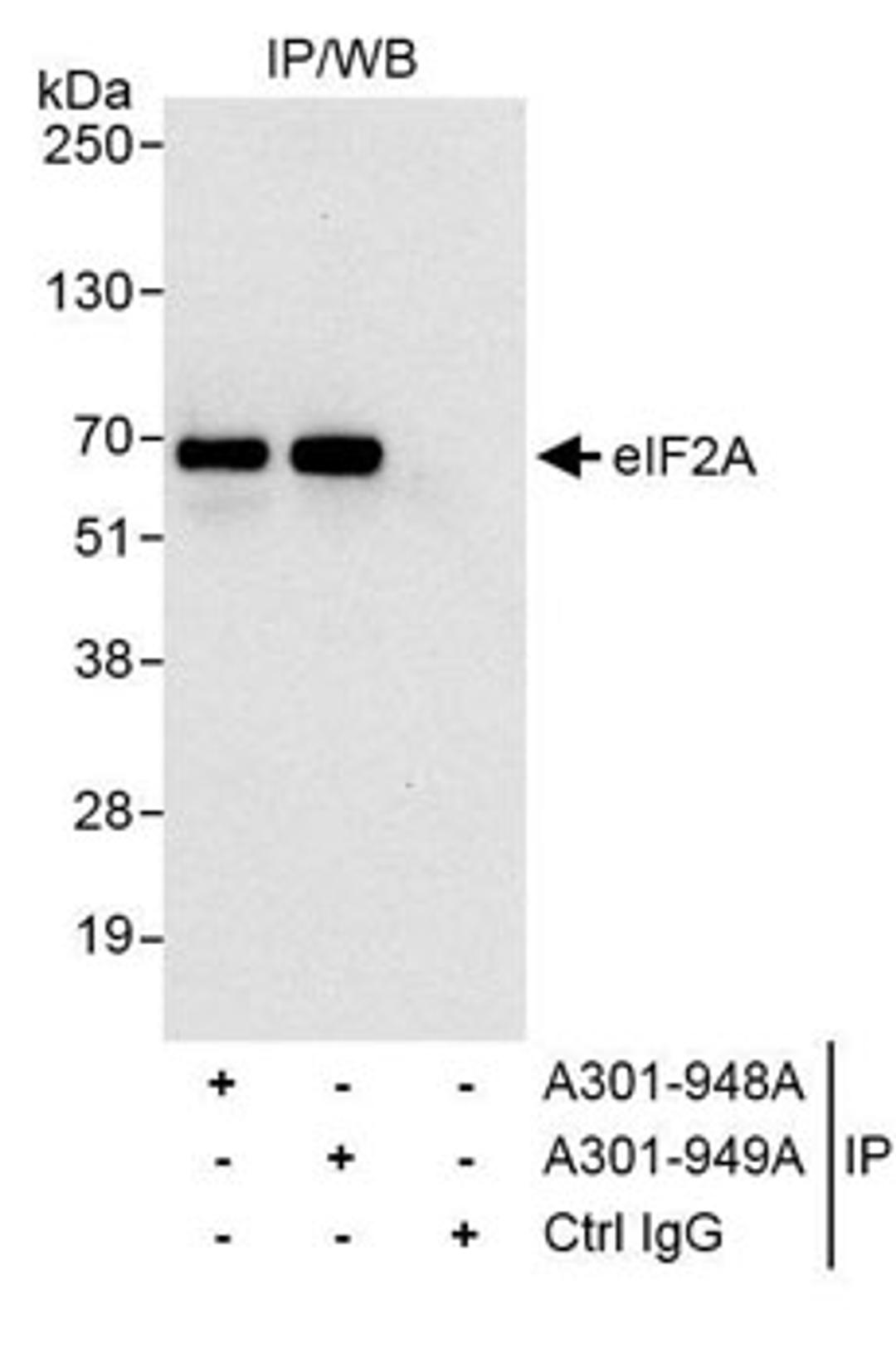 Detection of human eIF2A by western blot o fimmunoprecipitates.