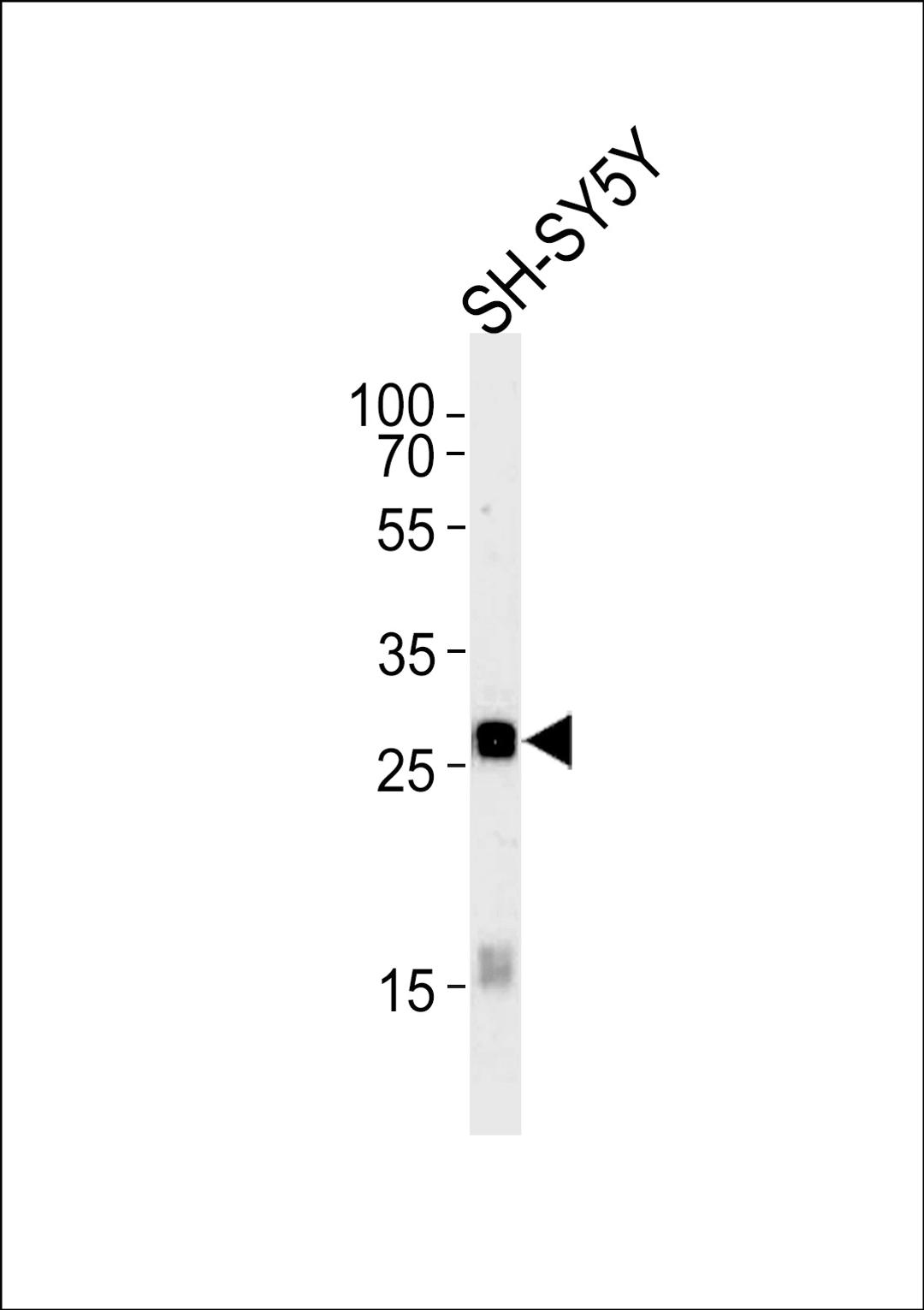 Western blot analysis in SH-SY5Y cell line lysates (35ug/lane).